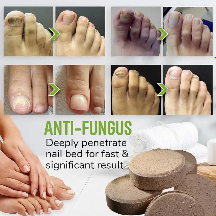 Anti-fungal Herbal Foot Soak (10 Pcs)