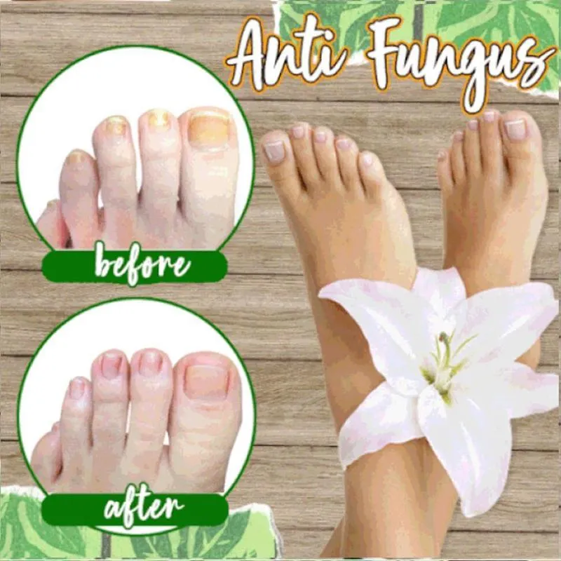 Anti-fungal Herbal Foot Soak (10 Pcs)