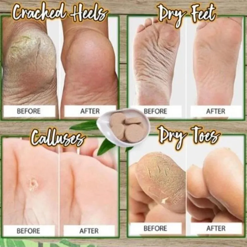 Anti-fungal Herbal Foot Soak (10 Pcs)