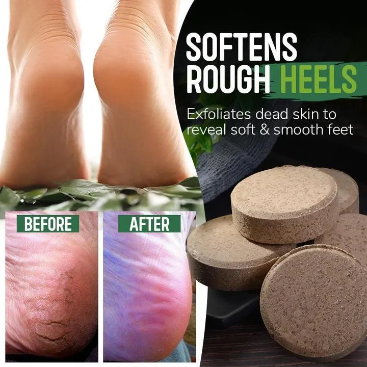 Anti-fungal Herbal Foot Soak (10 Pcs)