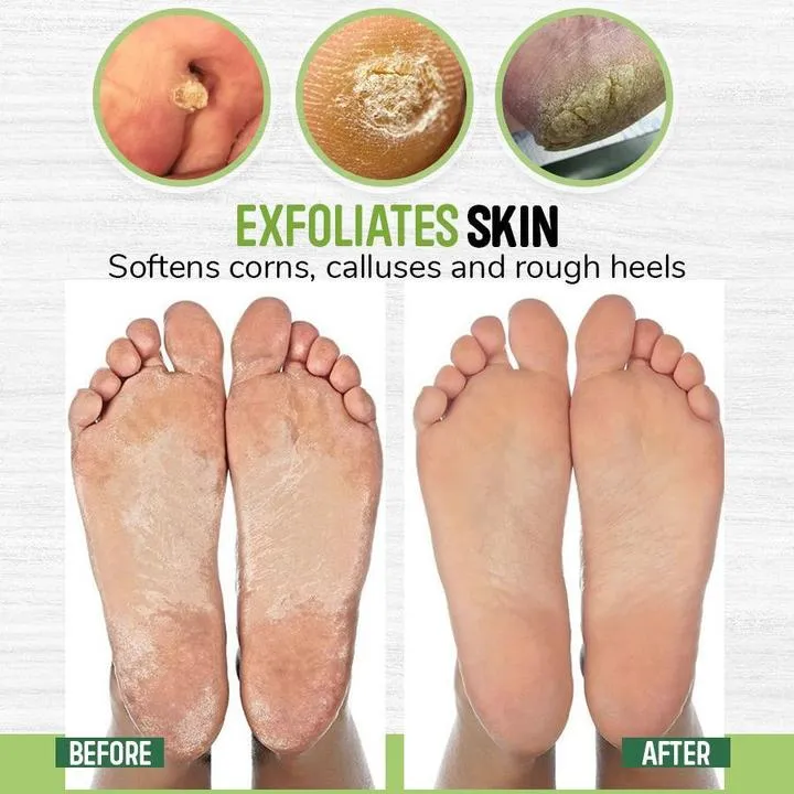 Anti-fungal Herbal Foot Soak (10 Pcs)